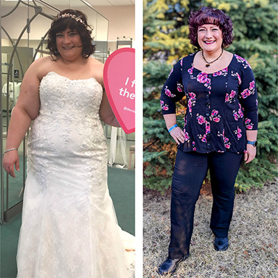 Before and after image of Becky Hubbard. In the before image, she is wearing her wedding dress. In the after image she is wearing a floral top.