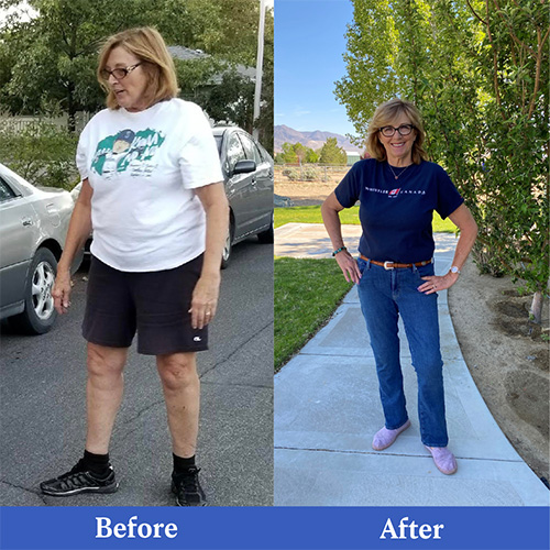 Before and after images of member Helaine, who lost 40 pounds with the Mayo Clinic Diet
